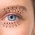 Blefaroplastyka czyli skuteczna terapia na poprawę widzenia wynikającego z opadającej powieki